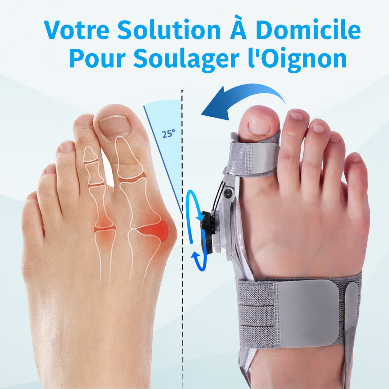 Qore+™ Correcteur d'Oignon — Hallux Valgus