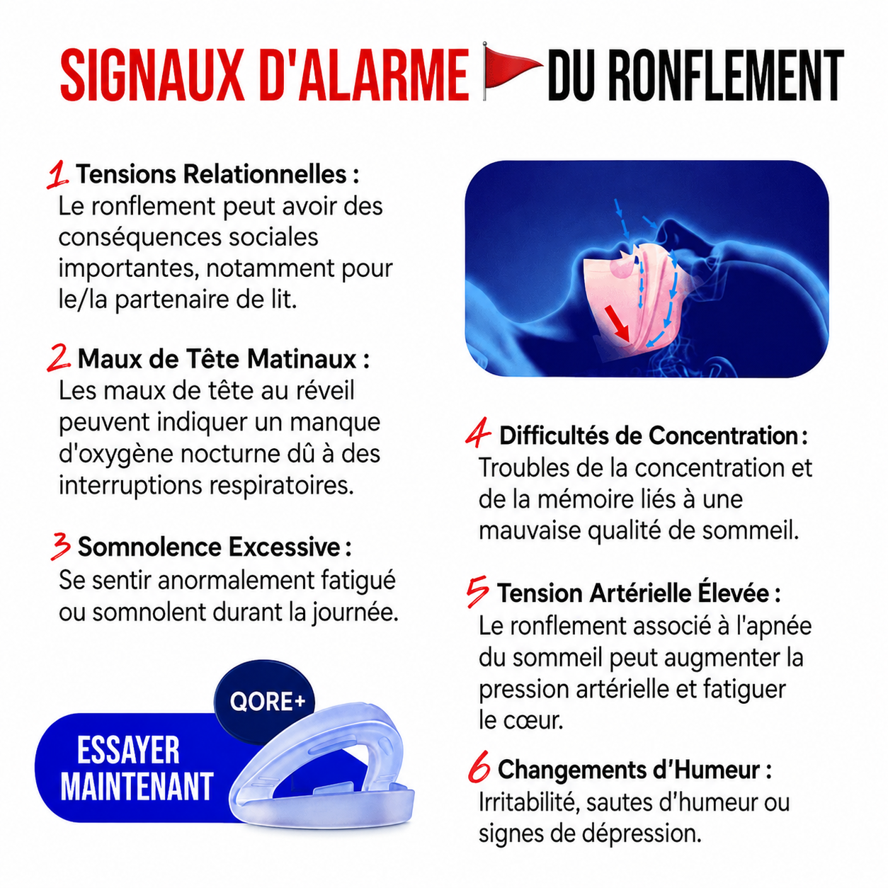 Gouttière Anti-Ronflement Taille Universelle
