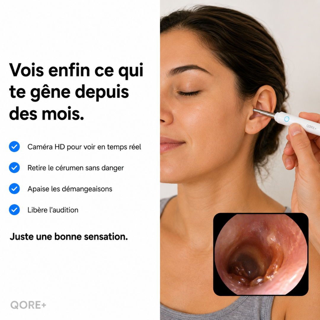 Qore+ VISION