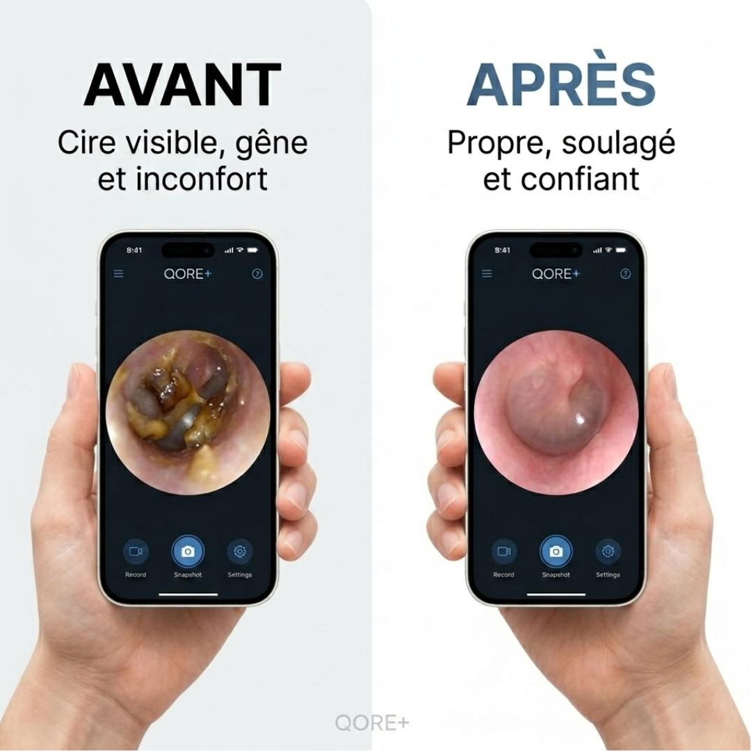 Qore+ VISION